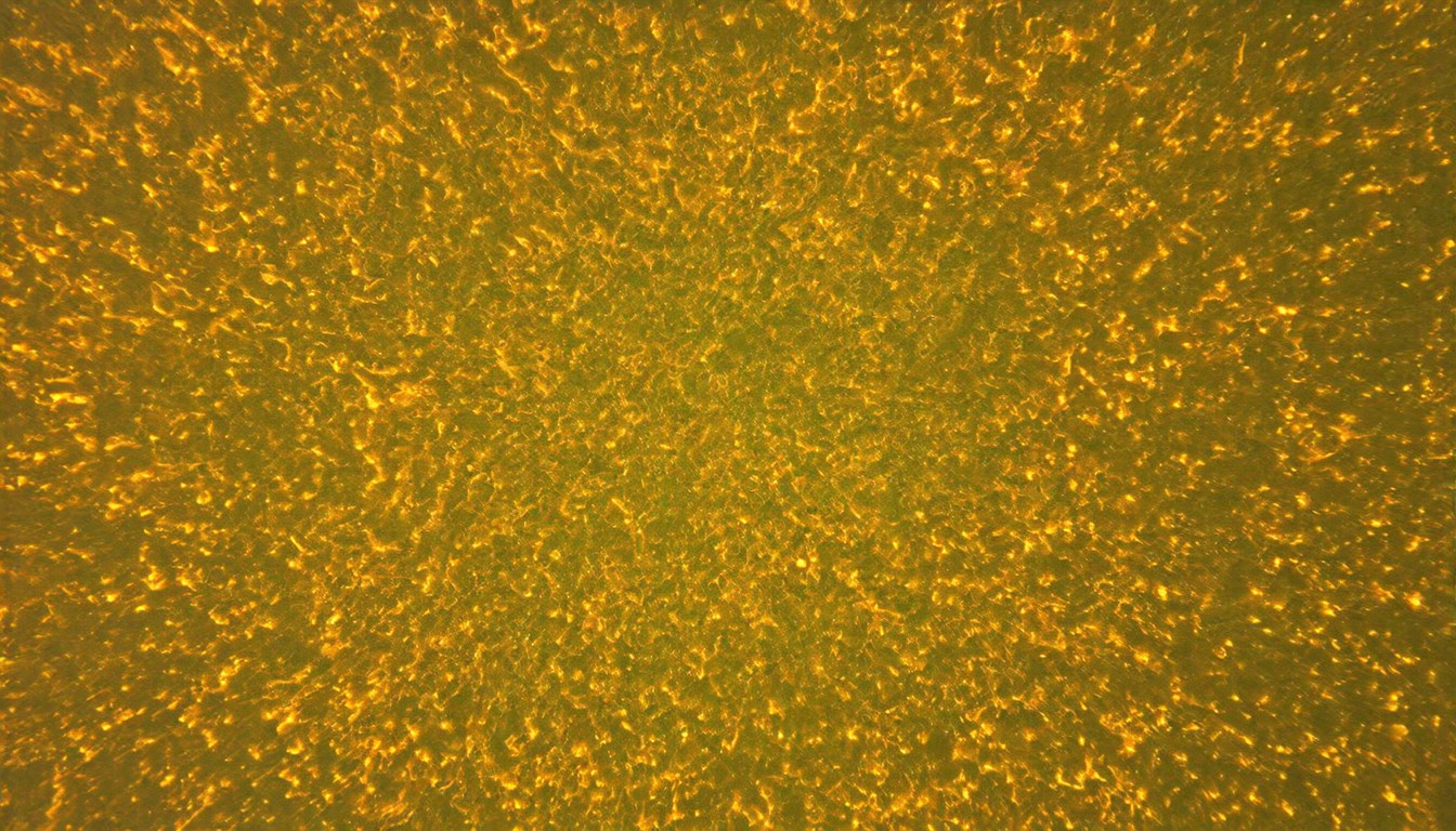 Epigenetic Strategy Restores Tumor Suppressor in Acute Myeloid Leukemia Models