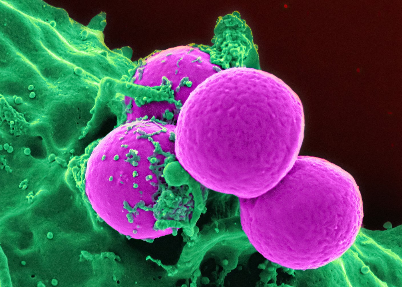 Forget Antibiotics: These Killer Cells Wipe Out Deadly Superbugs in a Day
