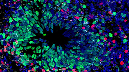 An Ethical Future for Brain Organoids Takes Shape