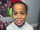 Incredibly brave boy, 10, seen for first time since medical jet crash that burned 90% of his body