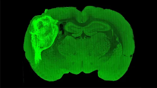 Lab-Grown Human Cells Form Working Circuits in Rat Brains